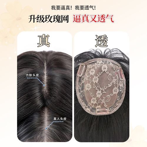 【不用戴发网】刘海假发片头顶蓬松高颅顶日常遮白发增发量补发块