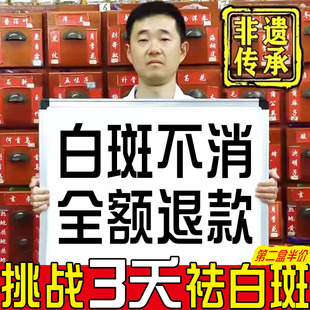补骨脂酊癜风药膏快速消白斑遮盖液黑色素生长外用修复专正品特效
