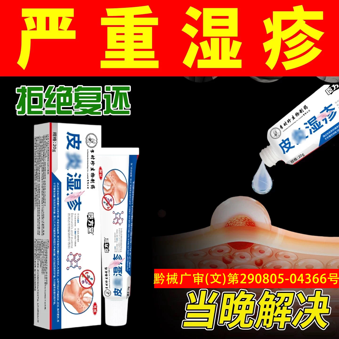 ⭐~湿疹皮炎~已帮助831555人