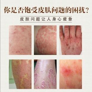 百紫透芙紫草透芙丁香草本乳膏抑菌乳膏苗坊草本皮肤健康g盒