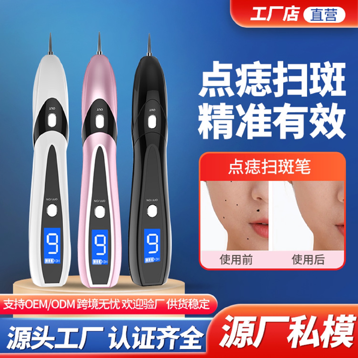 厂家直销美容笔去痣家用扫斑机点痣笔激光美容仪取痣仪