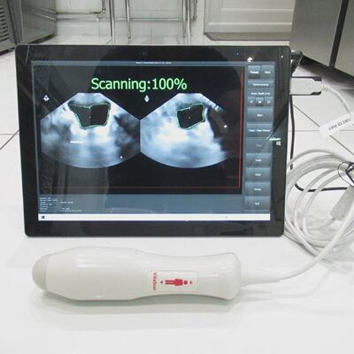 VITACON VITASCAN V2 PORTABLE PATIENT 3D ULTRASOUND IMAGE SCA