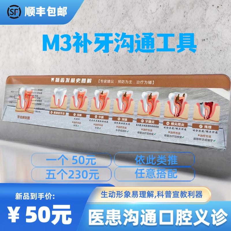 种植牙根管RCT龋齿牙周发展定制模型办公医患沟通牙科沟通工具