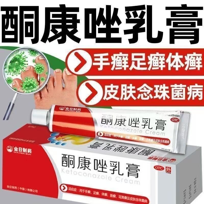 体股癣手足癣 花斑癣皮肤念珠菌 抗真菌止痒膏 金日酮康唑乳膏25g