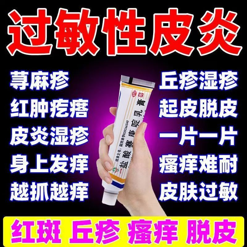 缓解荨麻疹 湿疹 皮肤瘙痒不适 止痒五洲通盐酸赛庚啶乳膏10g