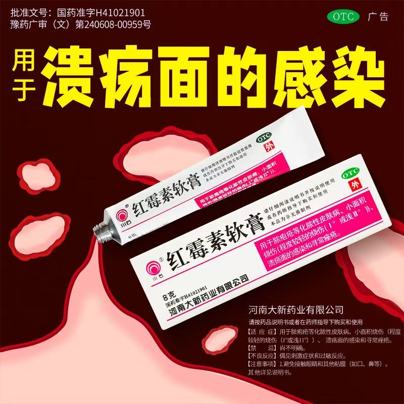 寻常痤疮痘痘红肿 脓疱疮烧伤溃疡感染 川石红霉素软膏8g