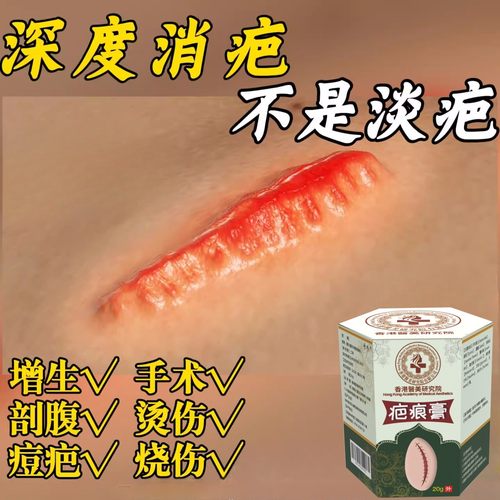 香港大药房祛疤痕膏痘印凹凸老手术除疤痕烫伤摔伤增生消疤修复膏