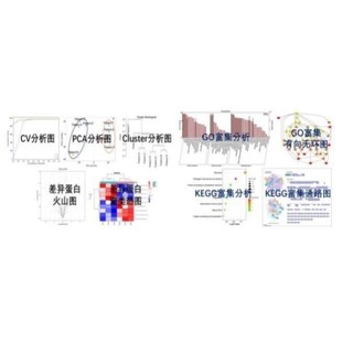 生信分析免疫浸润甲基化16s代谢组蛋白组TCGA GEO转录组数据分析