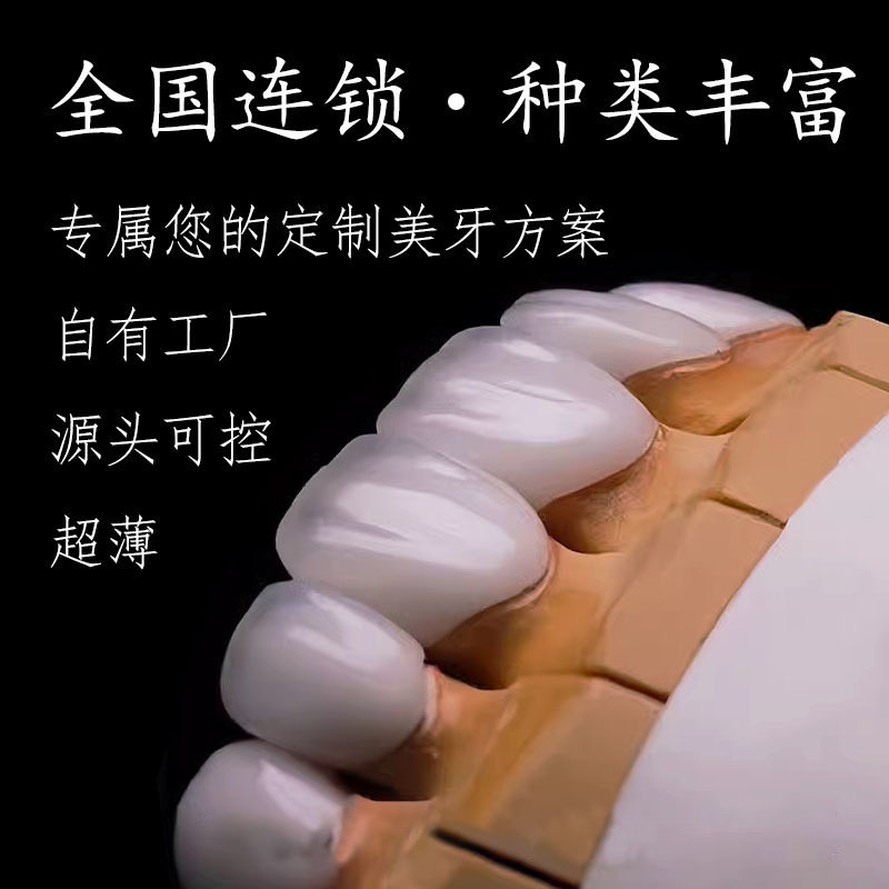 义获嘉全瓷贴面牙齿修复私人定制牙齿美白灵犀瓷琥珀蓝瓷网红同款
