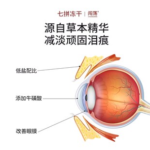 闯荡猫粮无谷鲜肉冻干生骨肉增肥发腮营养不掉毛成猫全价通用型