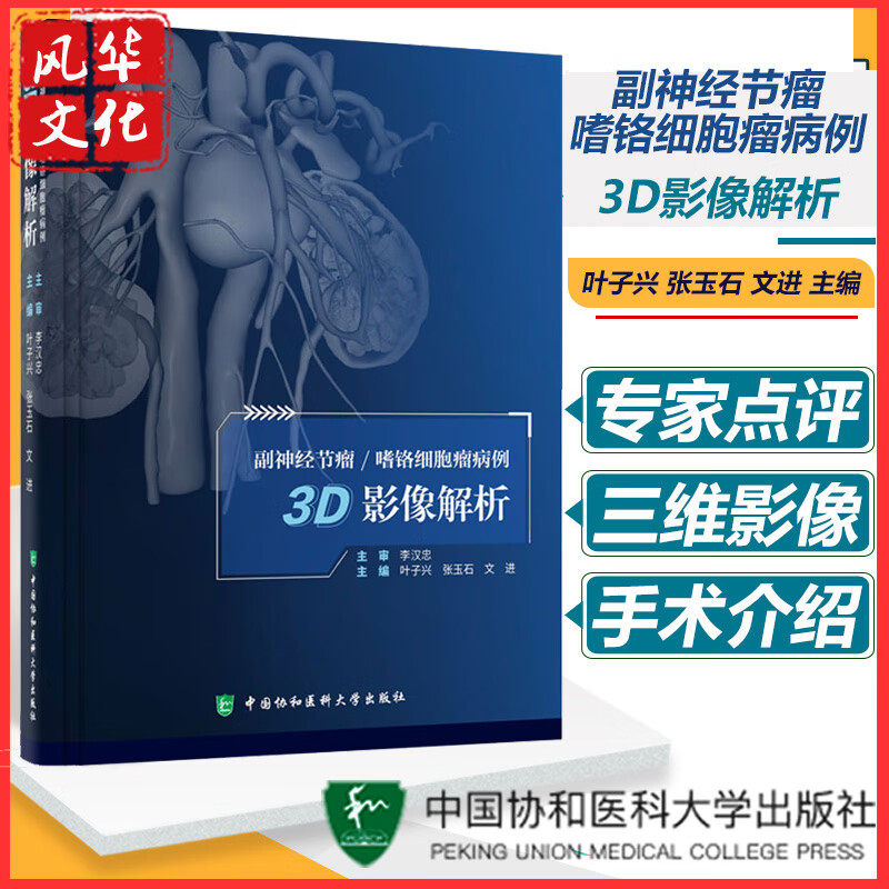 副神经节瘤嗜铬细胞病例3