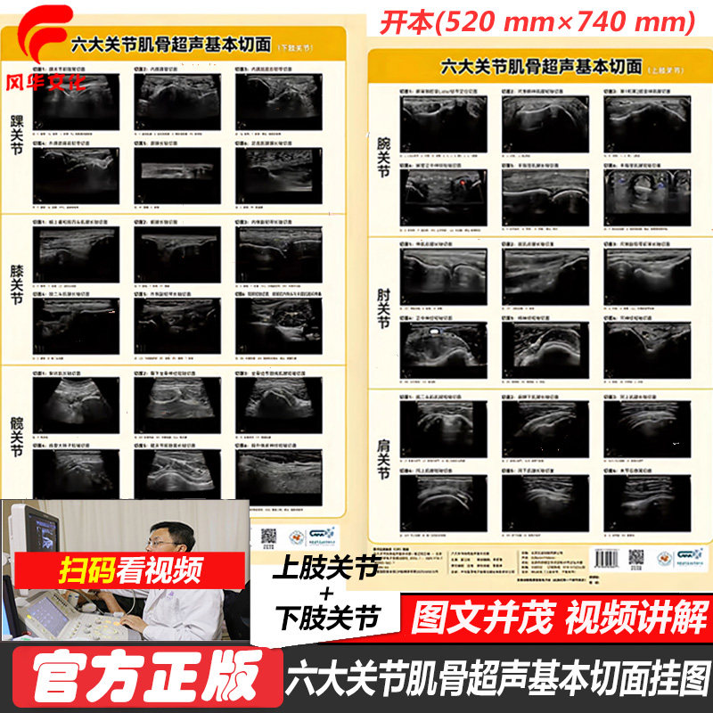六大关节肌骨超声基本切面挂图 上下肢关节医学资料 腕 肘 肩 踝 膝 髋 关节 实操视频彩超B超影像诊断 标准 图解谱