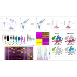生物信息学分析/单细胞测序分析/单细胞分析代码