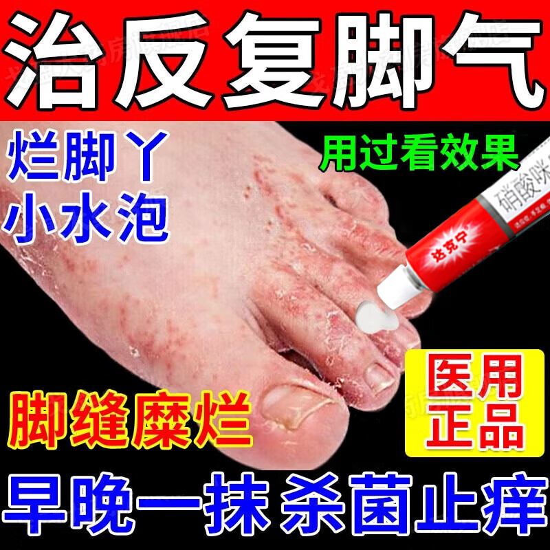 达克宁治脚气的官方旗舰店止痒脱皮杀菌真菌