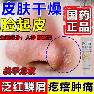 脂溢性皮炎面部皮肤干燥起皮脸上过敏皮肤修复脸部红痒参皇软膏
