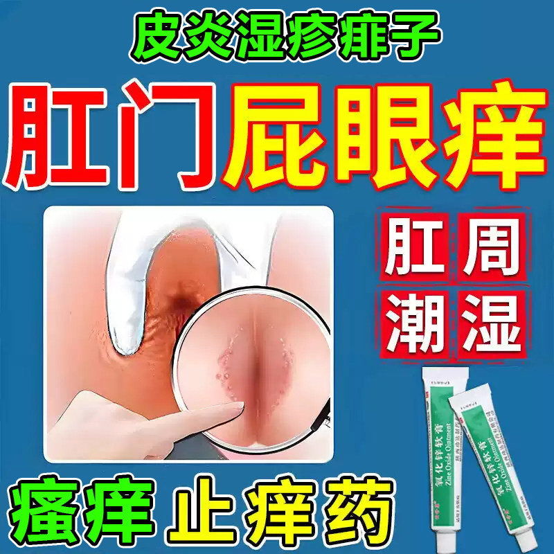 肛门瘙痒特专用效药肛周湿疹去潮湿根男女屁眼痒氧化锌软膏正品Z