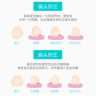 婴儿枕头0-1岁防偏头定型枕初生新生儿宝宝头型矫正纠正偏头纯棉u