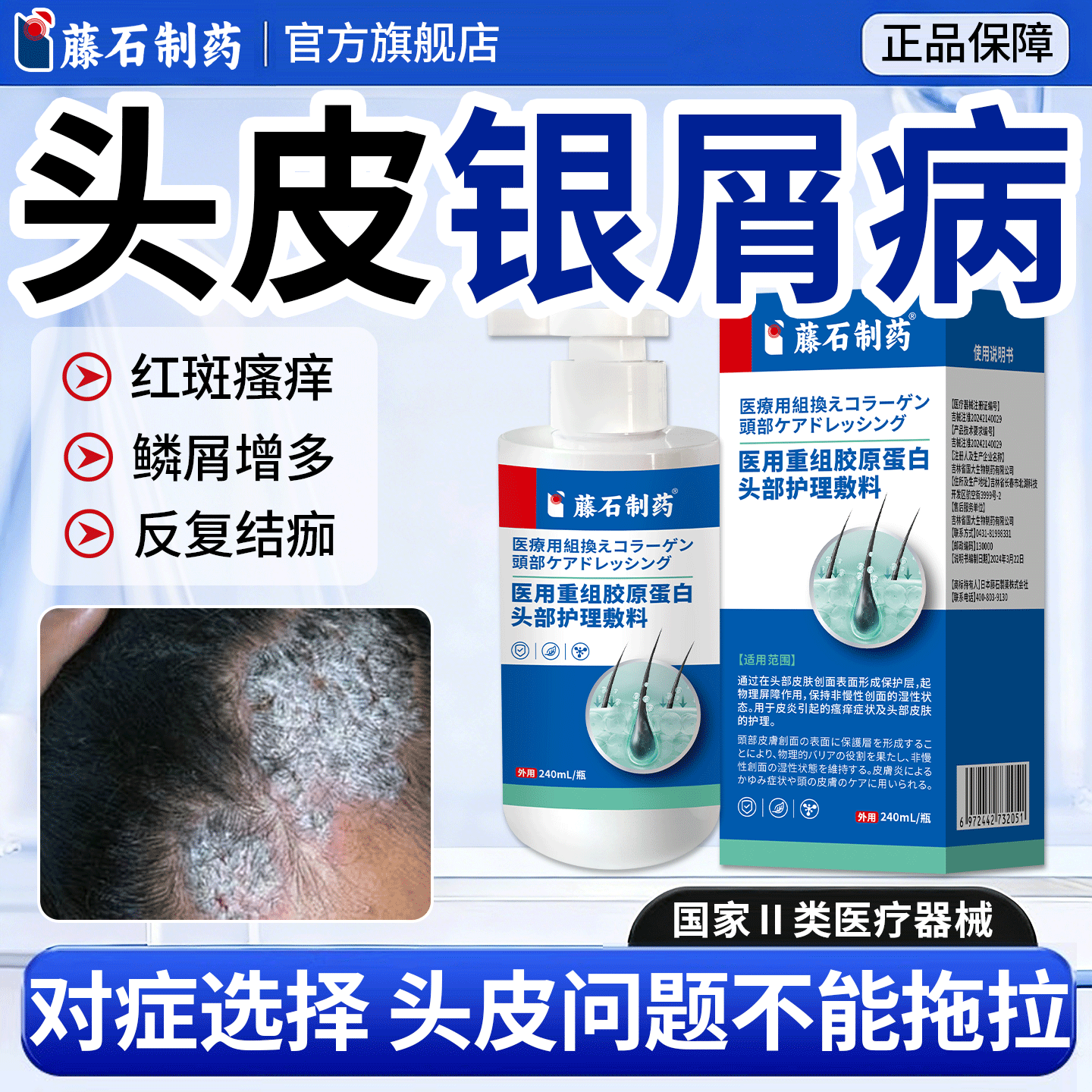 藤石制药头皮银屑病医用重组胶原蛋白牛皮藓护理瘙痒头屑红斑RD