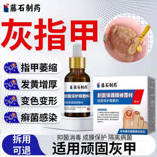 【藤石制药】指甲发黄增厚分层