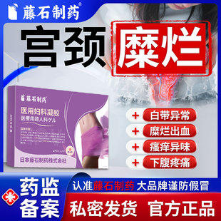 宫颈糜烂出血妇科凝胶阴道炎可搭益生菌白带异味瘙痒疼痛用药NP