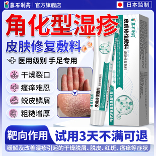 角化型手部湿疹手癣膏脱皮干裂真菌感染手掌专用手指足搭膏药贴E8
