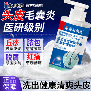 头皮长痘痘毛囊炎红疙瘩洗发水头部特专效用药监备案医用级ZZ