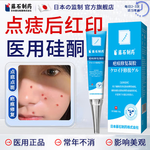 藤石制药激光点痣后去红印修复膏液祛疤膏医用硅酮疤痕修复凝胶SY