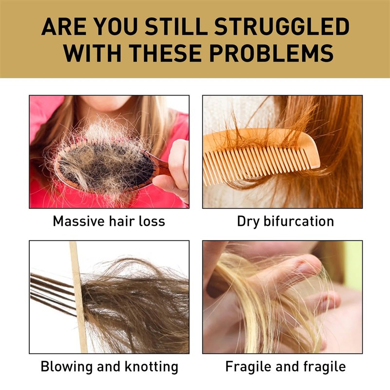 Ginger Regrowth Shampoo Anxti Hair Loss Oil Control Dandruff