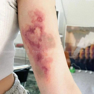 爱心淤青纹身贴病态美学男女ins手臂唯美氛围感防水持久可洗逼真