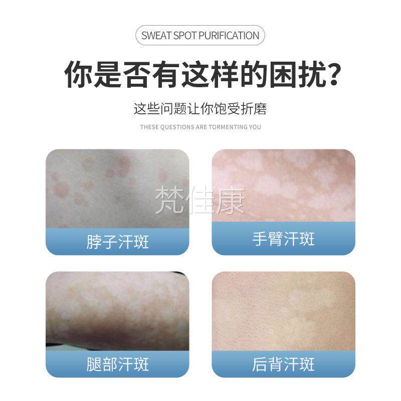 广州白云汗斑净汗肤斑斑癣祛花汗山褐斑露喷剂皮外用EJI乳膏正品