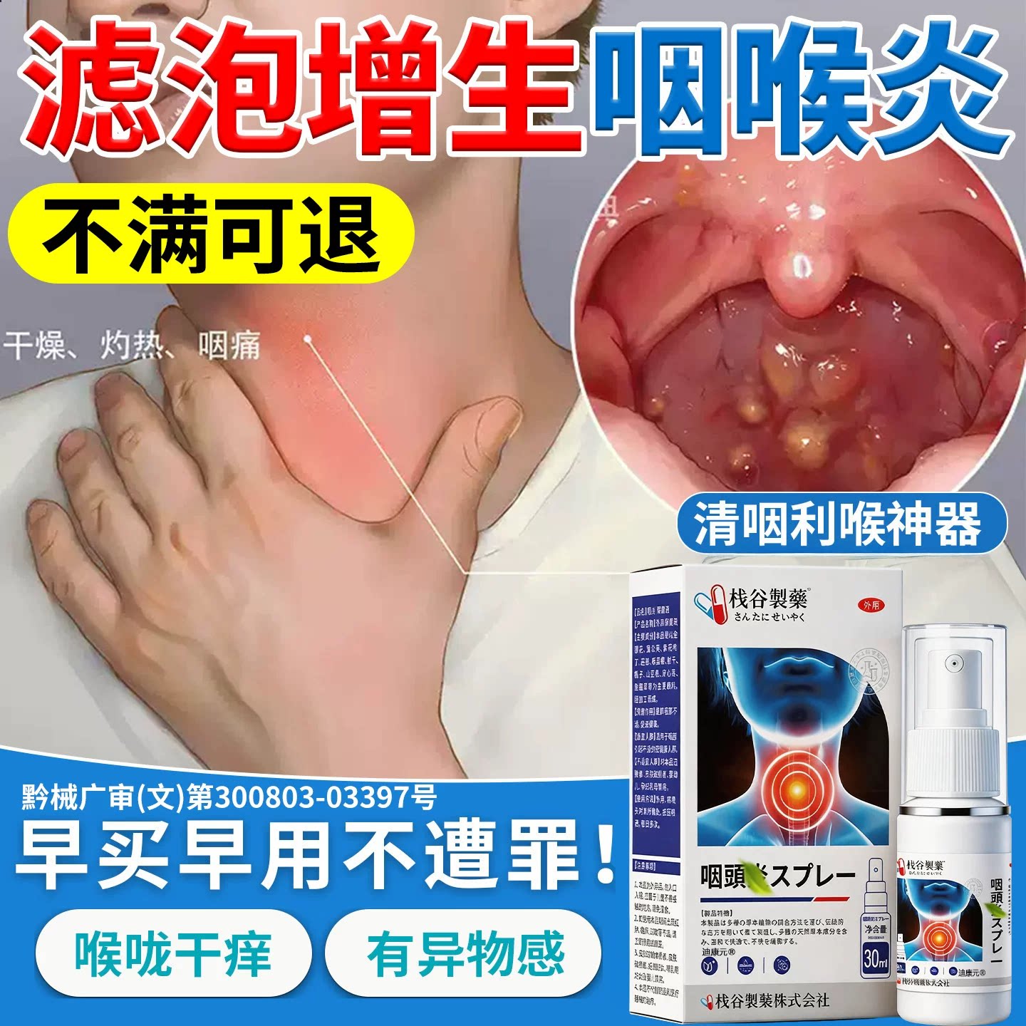 喉咙滤泡增生慢性咽炎扁桃体发炎咳嗽喉咙有痰异物感化痰神器喷剂
