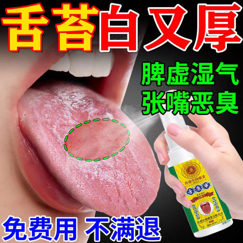 【舌苔白厚口臭肝火】舌康宁喷剂