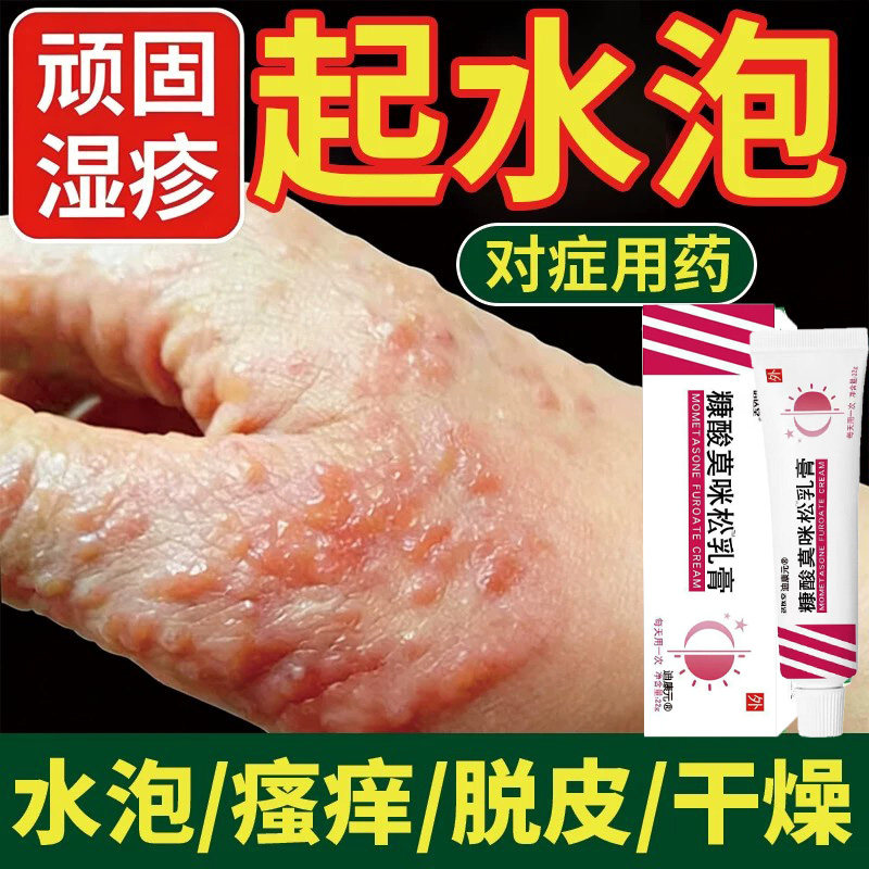 【汗疱一抹消疹】糠酸莫乳米松膏