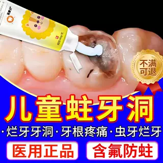 葵花儿童含氟防蛀牙龋齿蛀牙牙清理洞牙虫的药房同款抗敏成人KV