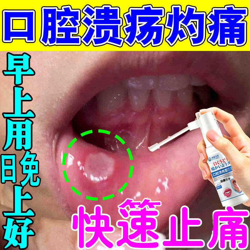 【无痛修护】日本口腔溃疡喷剂