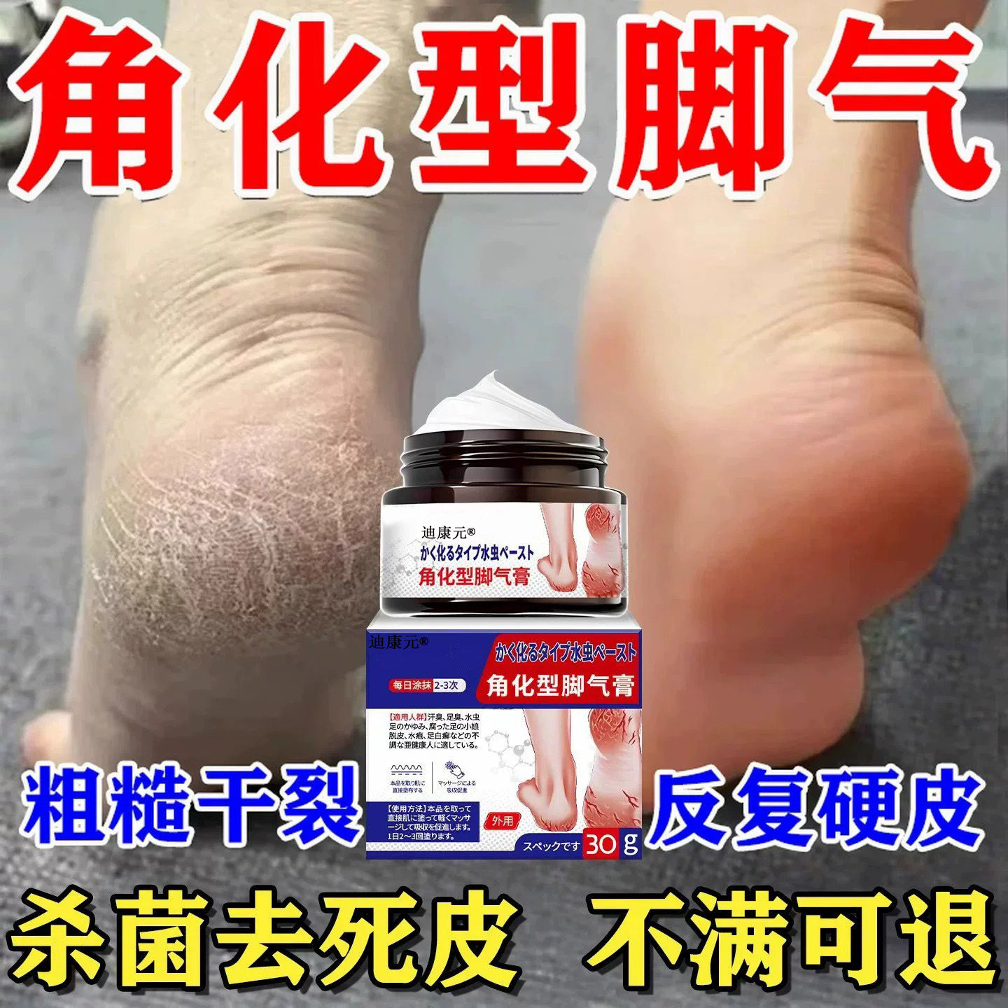 角化型脚气克星膏!软化老皮杀菌