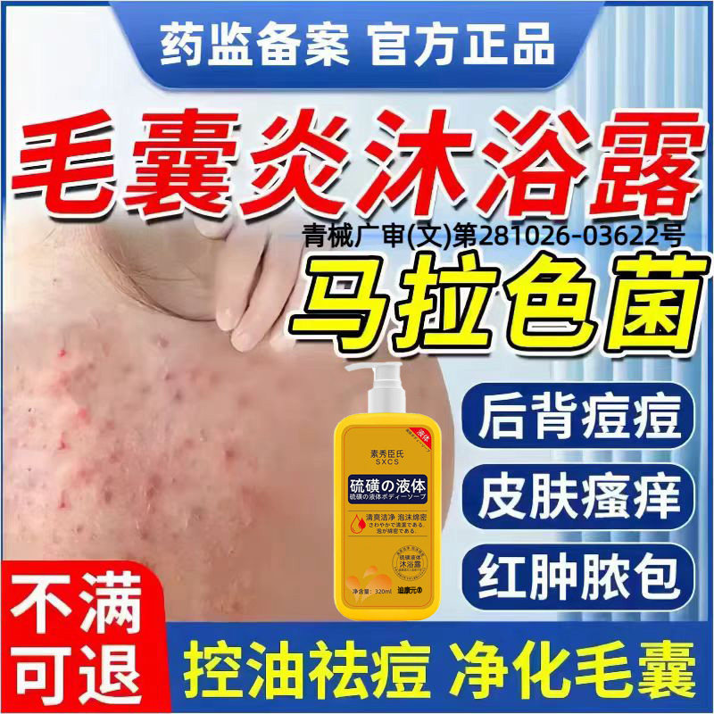 背后除螨痘痘毛囊脂溢炎沐浴露