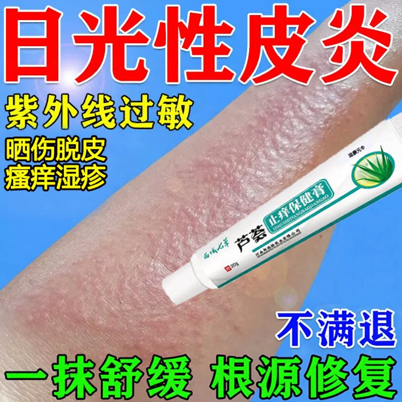 紫外线晒伤瘙痒湿疹脱皮保湿修复