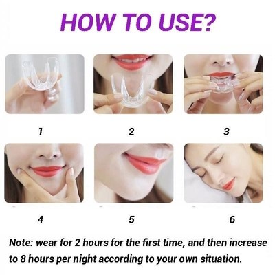 3 Stages Dental Orthodontic Teeth SilicKone Braces Appliance