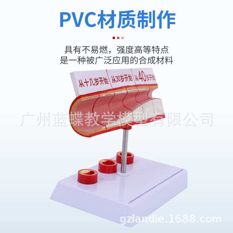 仿真人体冠状动脉性心血管动脉模型硬化模型老年心脏模型血栓模型