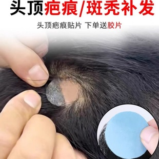 假发贴片真人发丝手工钩织生物头皮男女通用假发贴补伤疤贴斑秃