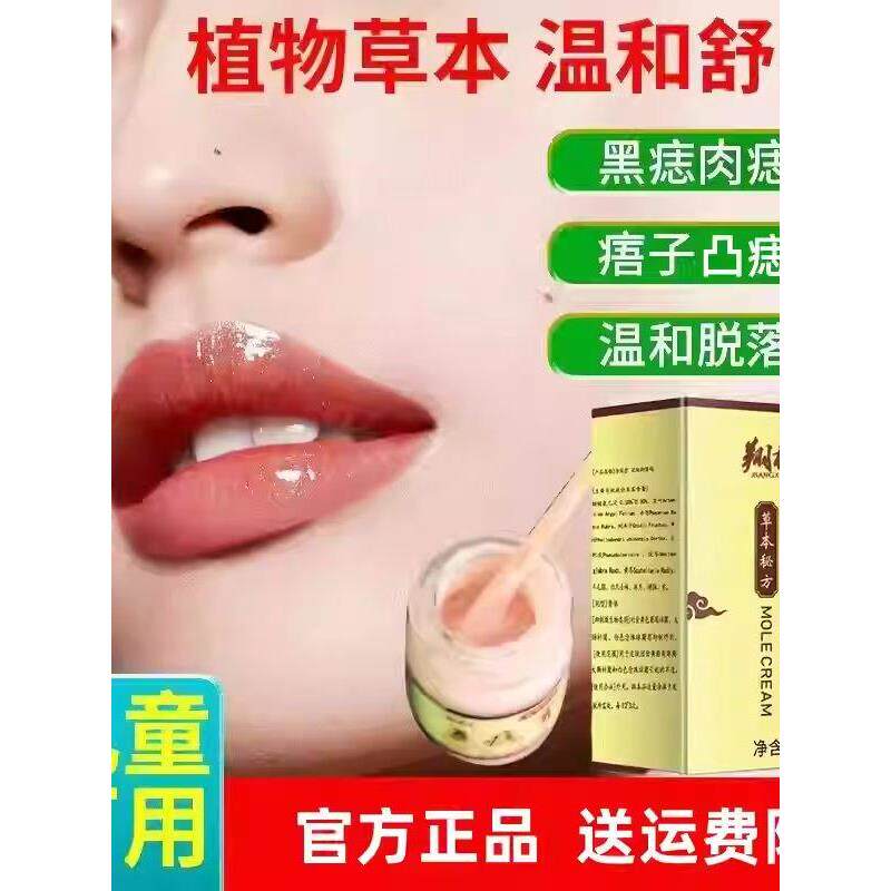 点痣膏无痕正品脸部点痦子取痣去黑痣专用点痣神器仪去黑点猴痦