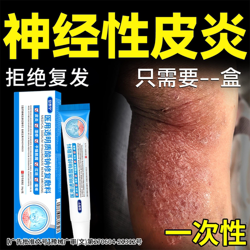 湿痒皮炎止痒膏医用透明质酸钠