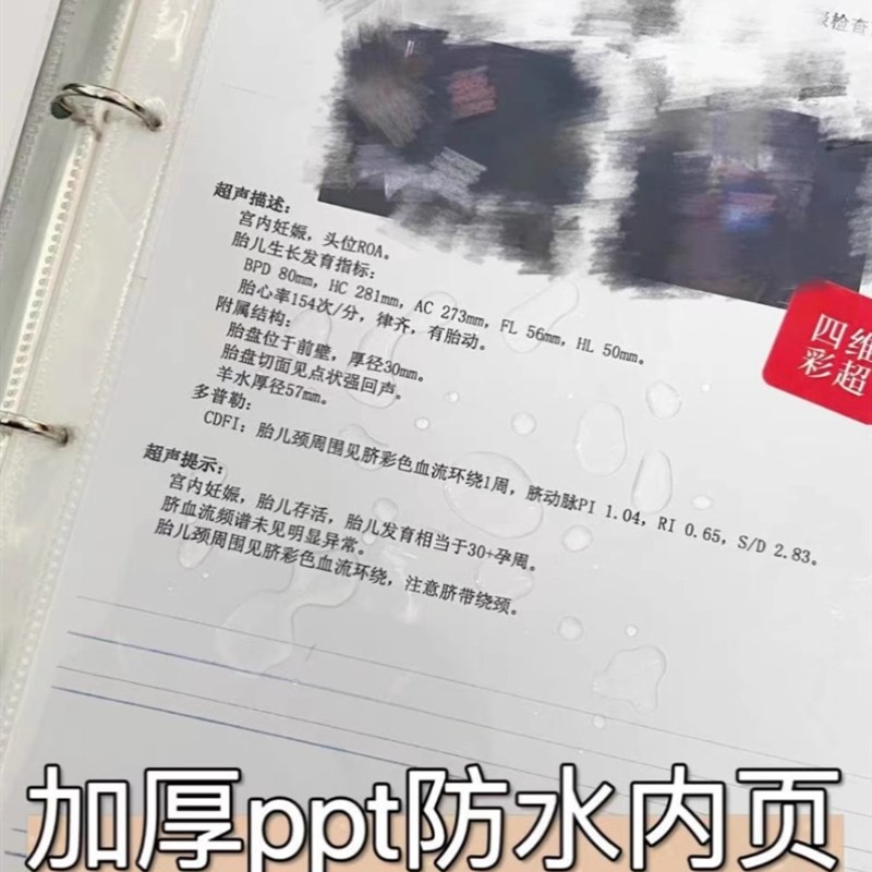 蛇宝宝产检收纳册宝妈孕检收纳册b超报告单资料册a4a5文件夹孕期