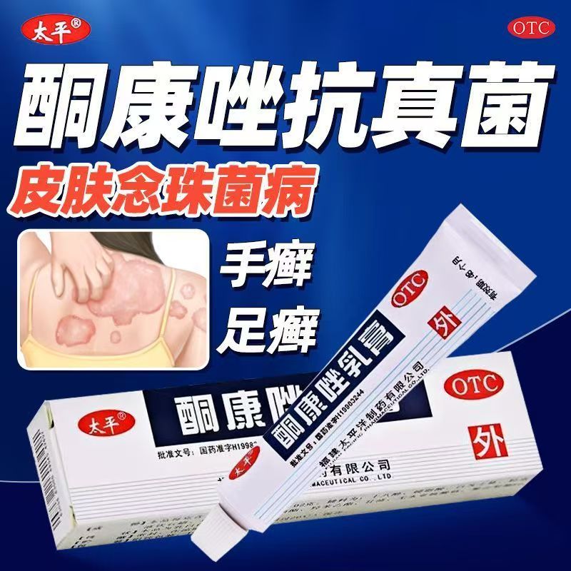 太平酮康唑乳膏10g用于手足癣症 杀菌止痒 缓解脱皮红肿 水疱不适