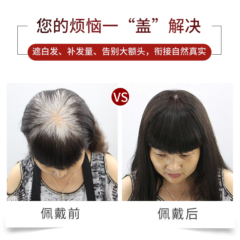 假发片女头顶遮白发蓬松增发量大面积自然无痕全真发头顶补发片女