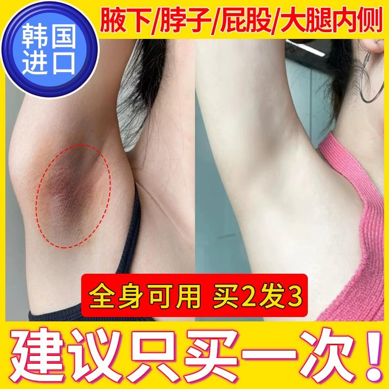 腋下去黑美白腋窝祛除黑色素沉淀胳肢窝去脖子胳膊肘关节屁股坐印