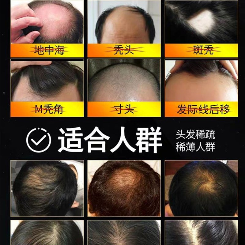 头发纤维粉发际线发缝密发补发增发神器美发粉遮盖头顶稀疏防脱发