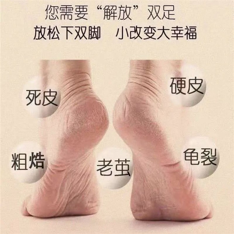 电动磨脚器充电式去后跟死皮厚茧专业修脚工具搓脚石刮脚磨脚神器