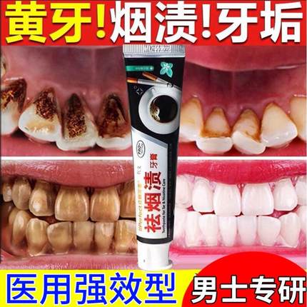 去烟渍的牙膏抗敏去黄去口臭美白强力溶解牙结石官方旗舰店正品CA